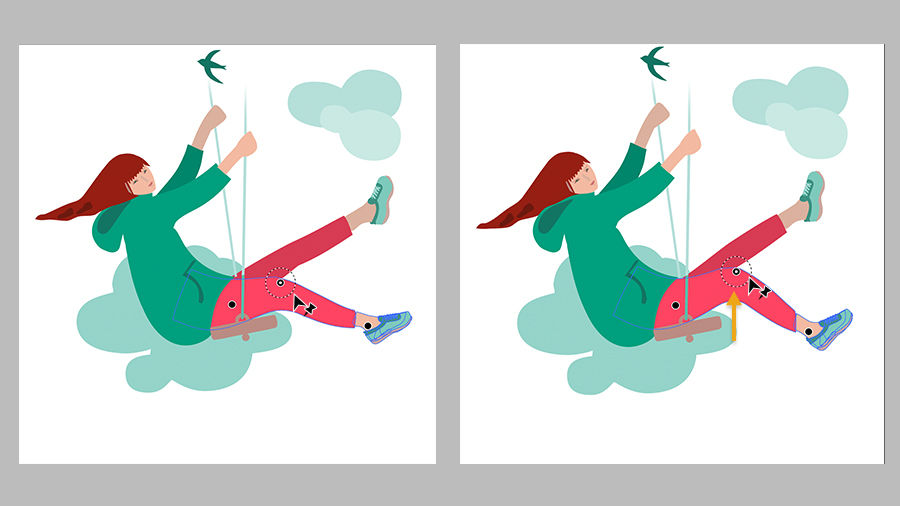 Side by side images of girl on swing with placement of pins on hip, knee, and ankle