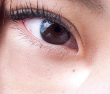 Underneath left eye healed in PS CC 2014 using Patch tool