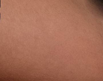 Healed in PS CC 2014 and older.