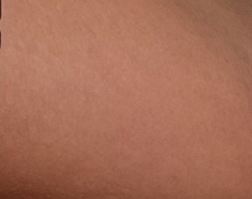 Healed in PS CC 2015.1 (Diffusion 2)