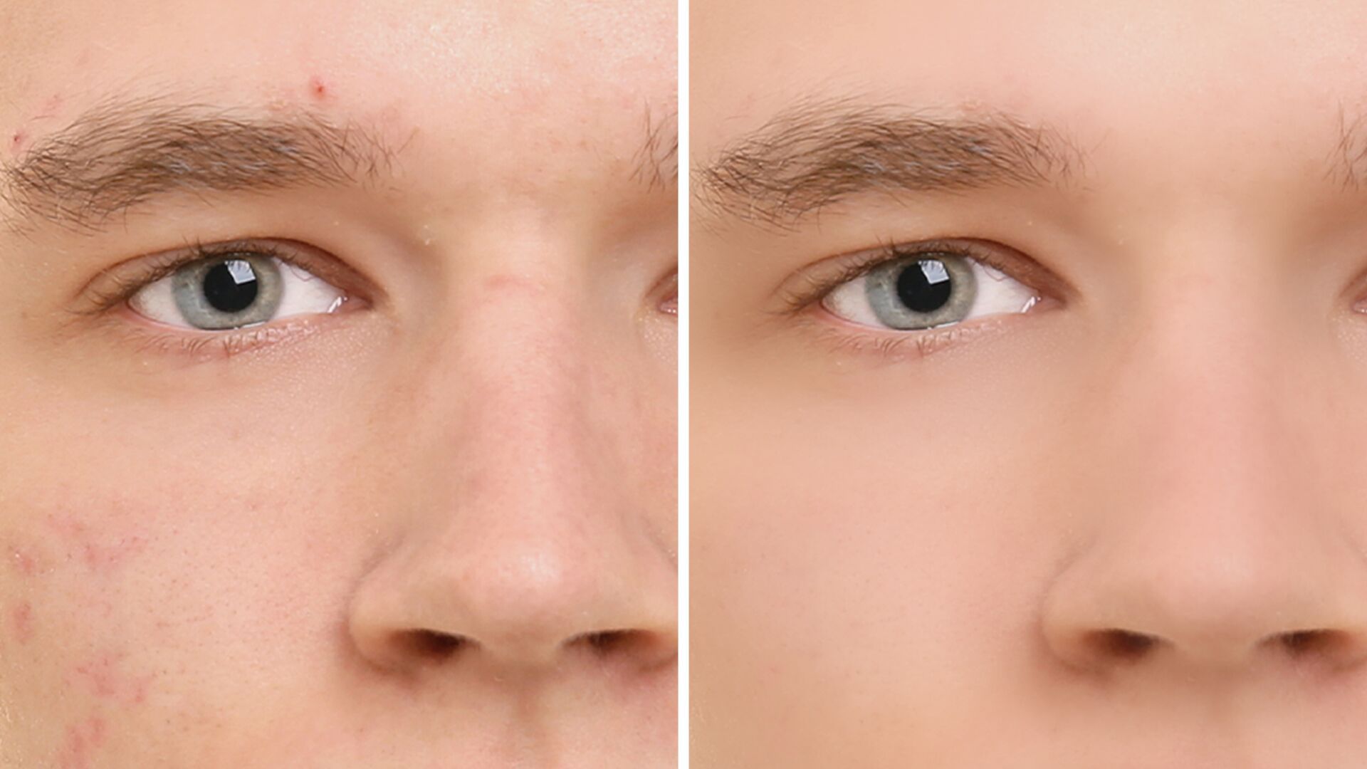 De huid op foto's effen maken