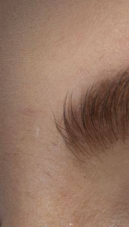 Виправлено за допомогою лікувального пензля у PS CC 2014 і раніших версій.